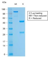 Data from SDS-PAGE analysis of Anti-bcl-2 antibody (Clone BCL2/1878R). Reducing lane (R) shows heavy and light chain fragments. NR lane shows intact antibody with expected MW of approximately 150 kDa. The data are consistent with a high purity, intact mAb.